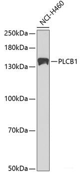 Immunohistochemistry of paraffin-embedded Human colon carcinoma using TNFSF10 Polyclonal Antibody at dilution of  1:200 (40x lens).