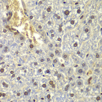 Immunofluorescence analysis of C6 cells using MALT1 Polyclonal Antibody at dilution of  1:100. Blue: DAPI for nuclear staining.