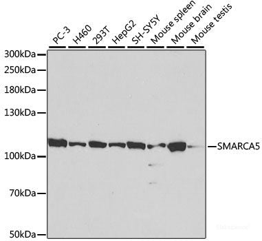 Immunohistochemistry of paraffin-embedded Human tonsil using ALOX5 Polyclonal Antibody at dilution of  1:100 (40x lens).