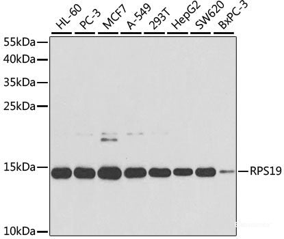 Immunohistochemistry of paraffin-embedded Rat lung using CD18 Polyclonal Antibody at dilution of  1:100 (40x lens).