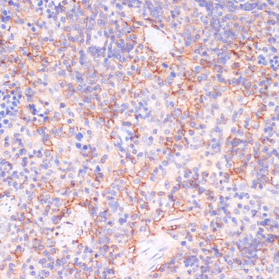 Immunohistochemistry of paraffin-embedded Rat lung using PDGFR beta Polyclonal Antibody at dilution of  1:100 (40x lens).