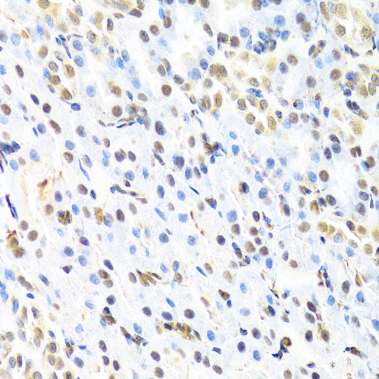 Immunohistochemistry of paraffin-embedded Rat testis using MRP4 / ABCC4 Polyclonal Antibody at dilution of  1:150 (40x lens).