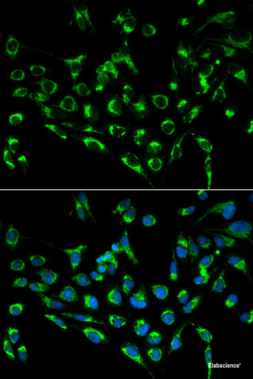 Immunofluorescence analysis of U-2 OS cells using MYST1 Polyclonal Antibody at dilution of  1:100 (40x lens). Blue: DAPI for nuclear staining.