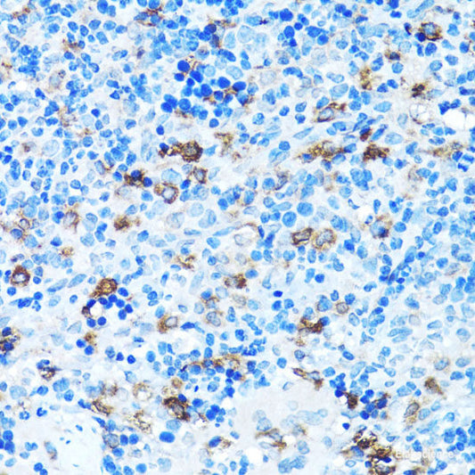 Western blot analysis of extracts of OVCAR-3 cells using CBX1 Polyclonal Antibody at dilution of 1:1000.