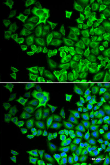 Immunohistochemistry of paraffin-embedded Rat lung using LEPREL2 Polyclonal Antibody at dilution of  1:200 (40x lens).