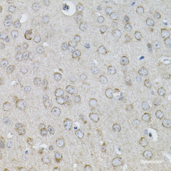 Immunohistochemistry of paraffin-embedded Rat testis using DNMT3L Polyclonal Antibody at dilution of  1:100 (40x lens).