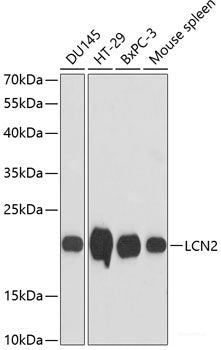Immunohistochemistry of paraffin-embedded Human breast using HAUSP / USP7 Polyclonal Antibody at dilution of  1:100 (40x lens).