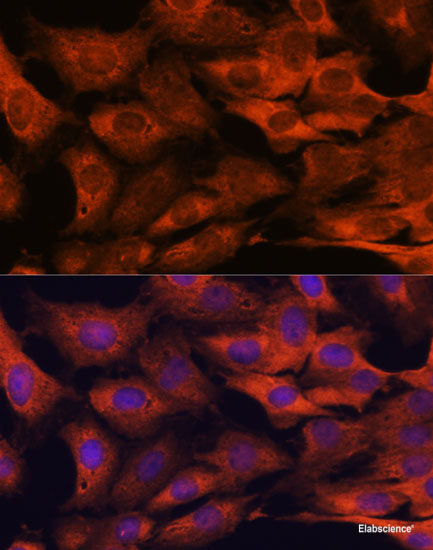 Immunohistochemistry of paraffin-embedded Human esophagus using CDK1 Polyclonal Antibody at dilution of  1:100 (40x lens).