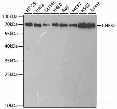 Immunohistochemistry of paraffin-embedded Human esophageal cancer using c-Fos Polyclonal Antibody at dilution of  1:100 (40x lens).