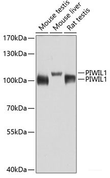 Immunohistochemistry of paraffin-embedded Rat heart using FLNB Polyclonal Antibody at dilution of  1:100 (40x lens).