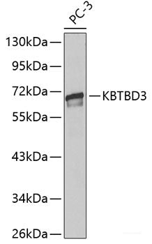 Immunohistochemistry of paraffin-embedded Rat liver using GTF2F1 Polyclonal Antibody at dilution of  1:200 (40x lens).