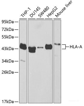 Immunohistochemistry of paraffin-embedded Rat brain using EEF1D Polyclonal Antibody at dilution of  1:200 (40x lens).