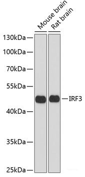 Immunohistochemistry of paraffin-embedded Mouse lung using ATP2C1 Polyclonal Antibody at dilution of  1:100 (40x lens).