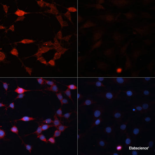 Western blot analysis of extracts of various cell lines using RPS3 Polyclonal Antibody at dilution of 1:1000.
