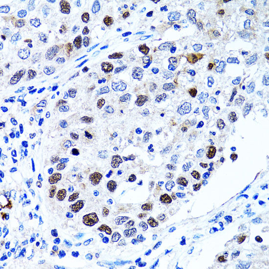 Immunohistochemistry of paraffin-embedded Rat spleen using CD19 Polyclonal Antibody at dilution of  1:100 (40x lens).