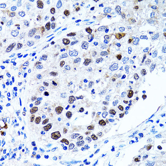 Immunohistochemistry of paraffin-embedded Rat spleen using CD19 Polyclonal Antibody at dilution of  1:100 (40x lens).