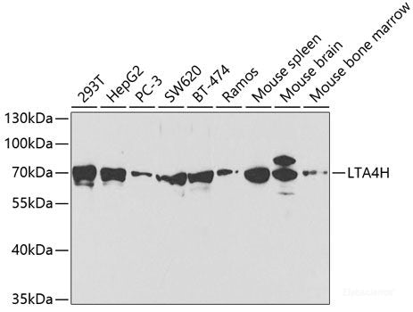 Immunohistochemistry of paraffin-embedded Mouse brain using CDH23 Polyclonal Antibody at dilution of  1:100 (40x lens).