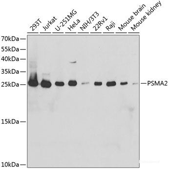 Immunohistochemistry of paraffin-embedded Rat spleen using PSMD3 Polyclonal Antibody at dilution of  1:200 (40x lens).