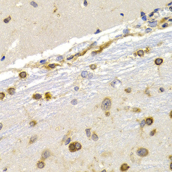 Immunohistochemistry of paraffin-embedded Rat liver using SERPINA3 Polyclonal Antibody at dilution of  1:100 (40x lens).