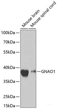 Immunohistochemistry of paraffin-embedded Mouse brain using ACHE Polyclonal Antibody at dilution of  1:100 (40x lens).