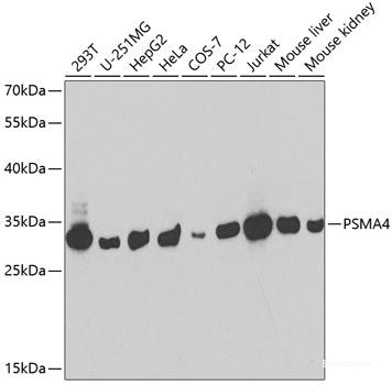 Immunohistochemistry of paraffin-embedded Human stomach using GPT Polyclonal Antibody at dilution of  1:100 (40x lens).