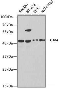 Immunohistochemistry of paraffin-embedded Mouse heart using CUL2 Polyclonal Antibody at dilution of  1:200 (40x lens).