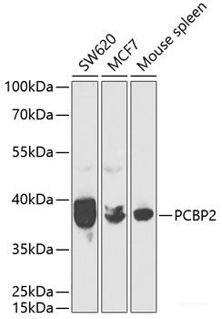 Immunohistochemistry of paraffin-embedded Rat lung using Aquaporin 4 Polyclonal Antibody at dilution of  1:100 (40x lens).