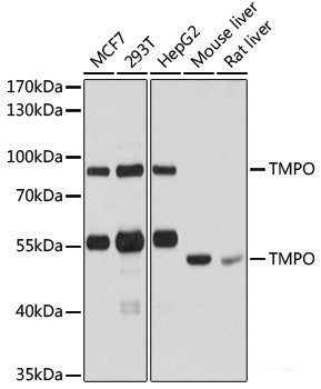 Immunohistochemistry of paraffin-embedded Human prostate using Cyclin A2 Polyclonal Antibody at dilution of  1:100 (40x lens).