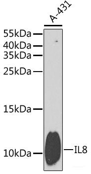 Immunohistochemistry of paraffin-embedded Rat testis using DDB1 Polyclonal Antibody at dilution of  1:100 (40x lens).