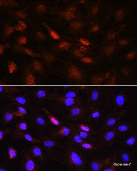 Immunohistochemistry of paraffin-embedded Human stomach using SFRP1 Polyclonal Antibody at dilution of  1:50 (20x lens).