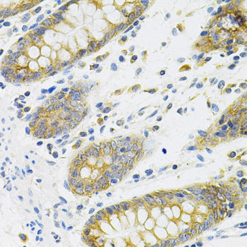 Immunohistochemistry of paraffin-embedded Human prostate using EPOR Polyclonal Antibody at dilution of  1:100 (40x lens).