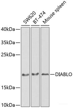Immunohistochemistry of paraffin-embedded Rat retina using GRK1 Polyclonal Antibody at dilution of  1:200 (40x lens).