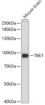 Immunofluorescence analysis of HeLa cells using HOXA11 Polyclonal Antibody at dilution of  1:100 (40x lens). Blue: DAPI for nuclear staining.
