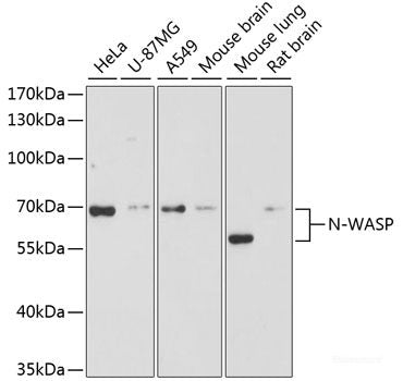 Immunohistochemistry of paraffin-embedded Human placenta using KLF5 Polyclonal Antibody at dilution of  1:100 (40x lens).