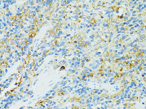 Immunohistochemistry of paraffin-embedded Rat kidney using KLK5 Polyclonal Antibody at dilution of  1:200 (40x lens).