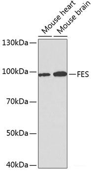 Western blot analysis of extracts of U-251MG cells using KCNA1 Polyclonal Antibody.
