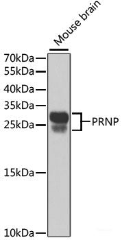 Immunohistochemistry of paraffin-embedded Rat pancreas using MCM4 Polyclonal Antibody at dilution of  1:100 (40x lens).