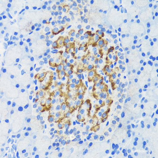 Immunohistochemistry of paraffin-embedded Mouse brain using SLC32A1 Polyclonal Antibody