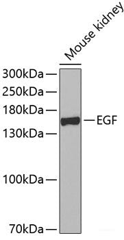 Immunohistochemistry of paraffin-embedded Human stomach using SSTR2 Polyclonal Antibody at dilution of  1:100 (40x lens).
