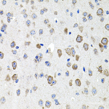 Immunohistochemistry of paraffin-embedded Mouse liver using YKL-40 / CHI3L1 Polyclonal Antibody at dilution of  1:100 (40x lens).