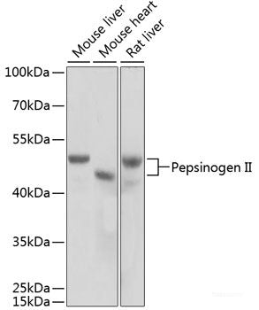 Immunofluorescence analysis of HeLa cells using CSF2RA Polyclonal Antibody at dilution of  1:100 (40x lens). Blue: DAPI for nuclear staining.