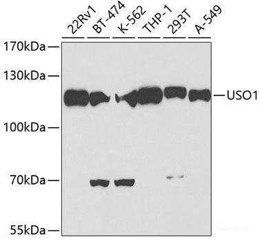 Immunofluorescence analysis of Rat kidney using LCN2 Polyclonal Antibody at dilution of  1:100. Blue: DAPI for nuclear staining.