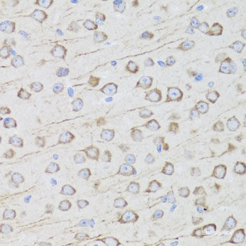 Immunofluorescence analysis of U2OS cells using ITGA6 Polyclonal Antibody at dilution of  1:100. Blue: DAPI for nuclear staining.
