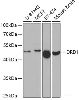 Immunohistochemistry of paraffin-embedded Human colon using UFD1L Polyclonal Antibody at dilution of  1:100 (40x lens).