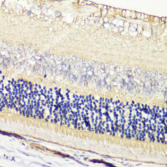 Immunohistochemistry of paraffin-embedded Rat testis using SLC39A7 Polyclonal Antibody at dilution of  1:100 (40x lens).