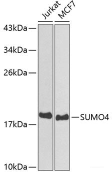 Immunofluorescence analysis of HeLa cells using ARF5 Polyclonal Antibody at dilution of  1:100. Blue: DAPI for nuclear staining.