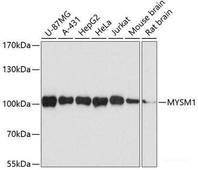 Immunohistochemistry of paraffin-embedded Human stomach using ASNA1 Polyclonal Antibody at dilution of  1:100 (40x lens).