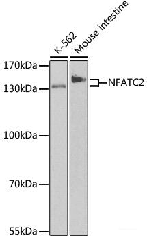 Immunohistochemistry of paraffin-embedded Human breast cancer using ATP5J Polyclonal Antibody at dilution of  1:100 (40x lens).