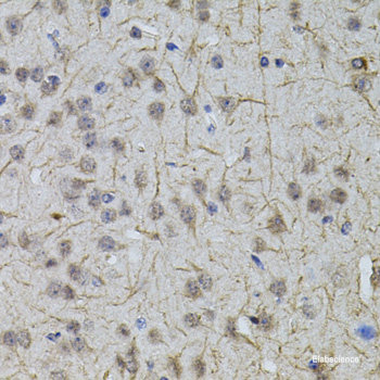 Immunofluorescence analysis of Raw264.7 cells using ENTPD1/CD39 Polyclonal Antibody at dilution of  1:100 (40x lens). Blue: DAPI for nuclear staining.