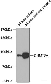 Immunohistochemistry of paraffin-embedded Human stomach using DYNC1I1 Polyclonal Antibody at dilution of  1:100 (40x lens).